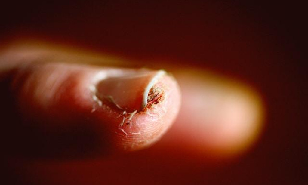 Ringworm and Other Contagious Skin Conditions: Facts vs Myths