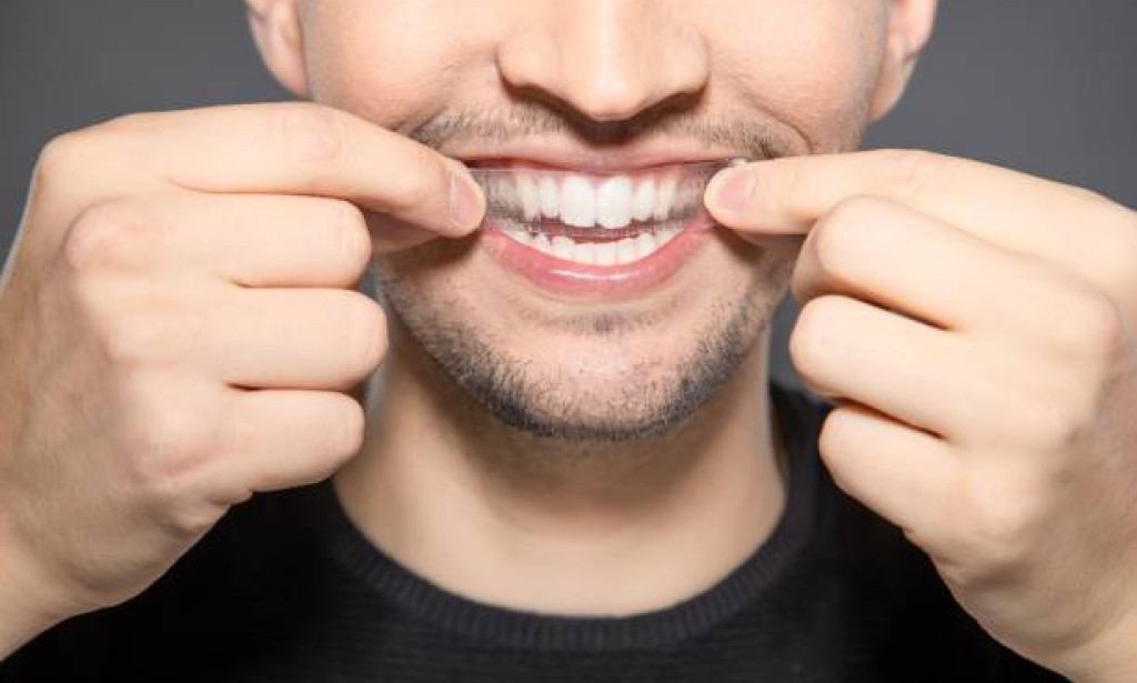 5 Fact Check on Teeth Whitening Strips from the Best Dentist in Nagpur!